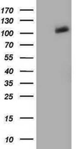 PDE2A Monoclonal Antibody (OTI5B10), TrueMAB , OriGene 100 &mu;L; Unconjugated:Antibodies,