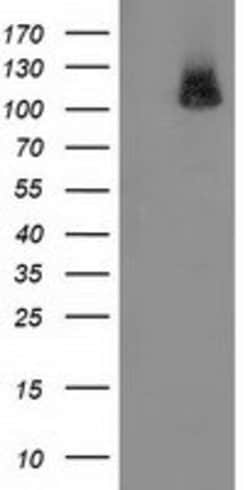 PDE2A Mouse anti-Human, Clone: OTI1G9, lyophilized, TrueMAB 100 &mu;g;