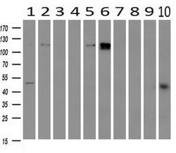 PDE2A Mouse anti-Human, Clone: OTI1G9, lyophilized, TrueMAB 100 &mu;g;