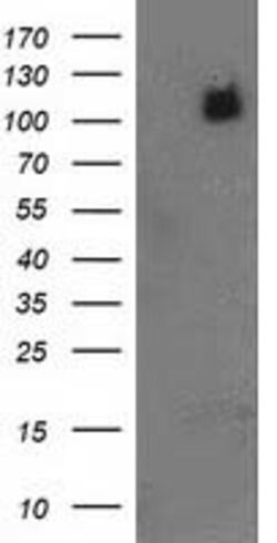 PDE2A Mouse anti-Human, Clone: OTI2F1, lyophilized, TrueMAB 100 &mu;g;