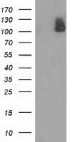 PDE2A Mouse anti-Human, Clone: OTI3A4, lyophilized, TrueMAB 100 &mu;g;