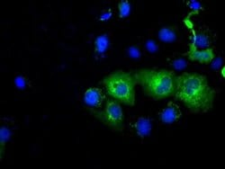 PDE4A Monoclonal Antibody (OTI8B7), TrueMAB , OriGene 100 &mu;L; Unconjugated:Antibodies,
