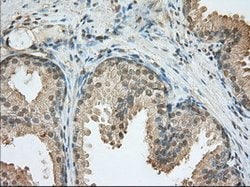 PDE4A Mouse anti-Human, Clone: OTI3D4, lyophilized, TrueMAB 100 &mu;g;
