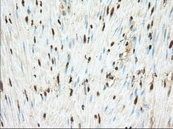 PDE4A Mouse anti-Human, Clone: OTI7B11, liquid, TrueMAB 100 &mu;L; Unconjugated:Antibodies,