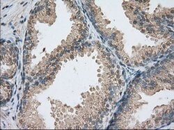 PDE4A Mouse anti-Human, Clone: OTI6B6, liquid, TrueMAB 100 &mu;L; Unconjugated:Antibodies,