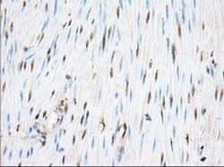 PDE4A Monoclonal Antibody (OTI6D6), TrueMAB , OriGene 100 &mu;L; Unconjugated:Antibodies,