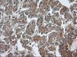 PDE4A Monoclonal Antibody (OTI6D6), TrueMAB , OriGene 100 &mu;L; Unconjugated:Antibodies,
