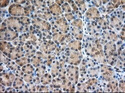 PDE4A Mouse anti-Human, Clone: OTI5C6, lyophilized, TrueMAB 100 &mu;g;