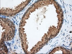 PDE4A Mouse anti-Human, Clone: OTI5C6, lyophilized, TrueMAB 100 &mu;g;