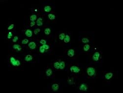PDE4B Mouse anti-Human, Mouse, Clone: OTI1D12, liquid, TrueMAB 100 &mu;L;