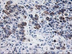 PDE4B Mouse anti-Human, Clone: OTI3B12, lyophilized, TrueMAB 100 &mu;g | Buy Online | Origene Technologies | Fisher Scientific