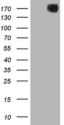 PDGFRA Monoclonal Antibody (OTI1A11), TrueMAB , OriGene 30 &mu;L; Unconjugated:Antibodies,