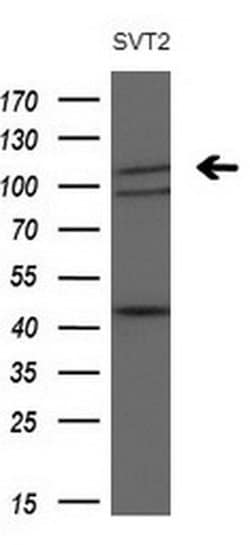 PDGFRA Monoclonal Antibody (OTI1A11), TrueMAB , OriGene 30 &mu;L; Unconjugated:Antibodies,