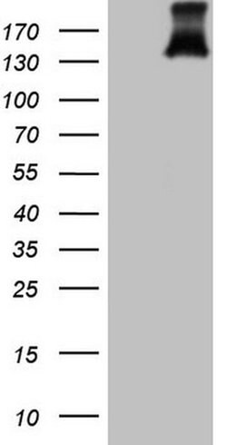PDGFRA Monoclonal Antibody (OTI4G5), TrueMAB , OriGene 30 &mu;L; Unconjugated:Antibodies,