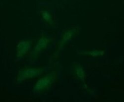 PDGFRB Monoclonal Antibody (OTI1D1), TrueMAB , OriGene:Antibodies:Primary