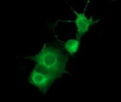 PDGFRB Monoclonal Antibody (OTI1G9), TrueMAB , OriGene:Antibodies:Primary