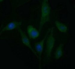PDGFRB Monoclonal Antibody (OTI1G9), TrueMAB , OriGene 100 &mu;L; Unconjugated:Antibodies,