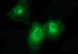 PDGFRB Mouse anti-Human, Clone: OTI1E8, liquid, TrueMAB 100 &mu;L; Unconjugated:Antibodies,