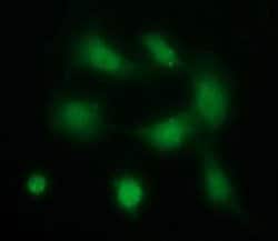 PDGFRB Monoclonal Antibody (OTI3B5), TrueMAB , OriGene 100 &mu;L; Unconjugated:Antibodies,