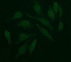 PDGFRB Monoclonal Antibody (OTI3B5), TrueMAB , OriGene 100 &mu;L; Unconjugated:Antibodies,