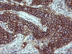 PDGFRB Mouse anti-Human, Clone: OTI1E8, liquid, TrueMAB 100 &mu;L; Unconjugated:Antibodies,