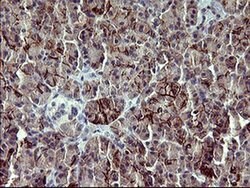 PDGFRB Mouse anti-Human, Clone: OTI1E8, liquid, TrueMAB 100 &mu;L; Unconjugated:Antibodies,