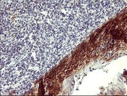 PDGFRB Mouse anti-Human, Clone: OTI1E8, liquid, TrueMAB 100 &mu;L; Unconjugated:Antibodies,