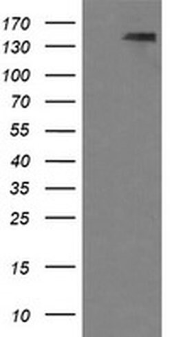 PDGFRB Monoclonal Antibody (OTI1D1), TrueMAB , OriGene 100 &mu;L; Unconjugated:Antibodies,