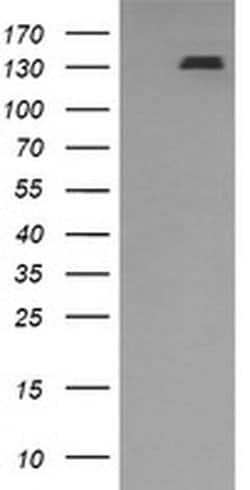 PDGFRB Monoclonal Antibody (OTI1G9), TrueMAB , OriGene:Antibodies:Primary