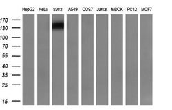 PDGFRB Monoclonal Antibody (OTI1G9), TrueMAB , OriGene 100 &mu;L; Unconjugated:Antibodies,