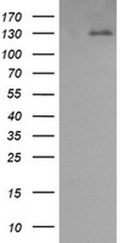 PDGFRB Monoclonal Antibody (OTI3B5), TrueMAB , OriGene 100 &mu;L; Unconjugated:Antibodies,