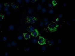 PDHA1 Monoclonal Antibody (OTI2C10), TrueMAB , OriGene 100 &mu;L; Unconjugated:Antibodies,