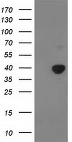 PDHA1 Monoclonal Antibody (OTI2C10), TrueMAB , OriGene 100 &mu;L; Unconjugated:Antibodies,