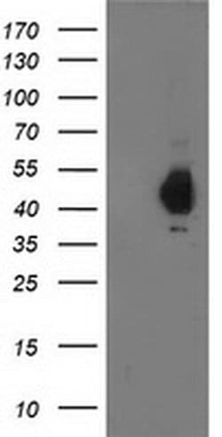 PDHA1 Monoclonal Antibody (OTI2B10), TrueMAB , OriGene:Antibodies:Primary