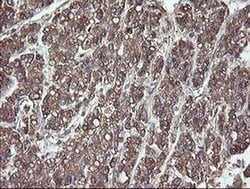 PDIA3 Monoclonal Antibody (OTI3H5), TrueMAB , OriGene 30 &mu;L; Unconjugated:Antibodies,