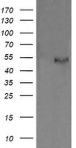 PDIA3 Mouse anti-Human, Clone: OTI2D2, lyophilized, TrueMAB 100 &mu;g;