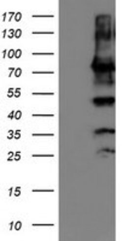 PDIA4 Mouse anti-Canine, Human, Clone: OTI2C11, lyophilized, TrueMAB 100