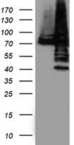 PDIA4 Mouse anti-Human, Clone: OTI2E11, lyophilized, TrueMAB 100 &mu;g;