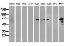 PDIA4 Mouse anti-Human, Clone: OTI2E11, lyophilized, TrueMAB 100 &mu;g;