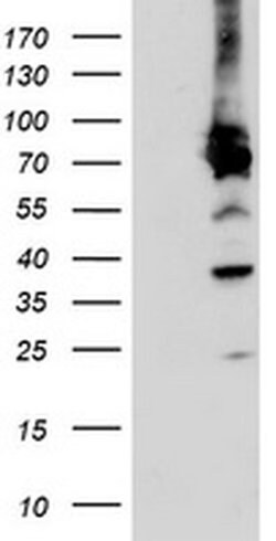 PDIA4 Monoclonal Antibody (OTI6B6), TrueMAB , OriGene:Antibodies:Primary