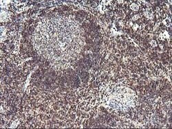 PDLIM2 Mouse anti-Canine, Human, Clone: OTI10C4, lyophilized, TrueMAB 100