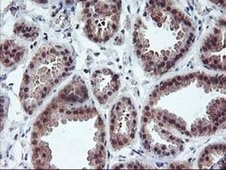 PDLIM2 Monoclonal Antibody (OTI3B5), TrueMAB , OriGene 30 &mu;L; Unconjugated:Antibodies,