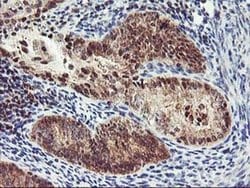 PDLIM2 Monoclonal Antibody (OTI3B5), TrueMAB , OriGene 30 &mu;L; Unconjugated:Antibodies,
