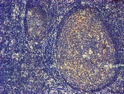 PDLIM2 Mouse anti-Human, Clone: OTI14D9, lyophilized, TrueMAB 100 &mu;g;