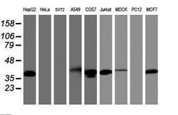 PDLIM2 Mouse anti-Canine, Human, Clone: OTI10C4, lyophilized, TrueMAB 100