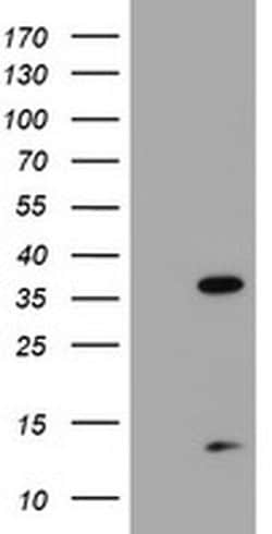 PDLIM2 Monoclonal Antibody (OTI3B5), TrueMAB , OriGene 30 &mu;L; Unconjugated:Antibodies,