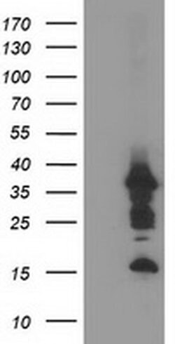 PDLIM2 Monoclonal Antibody (OTI9B6), TrueMAB , OriGene 100 &mu;L; Unconjugated:Antibodies,