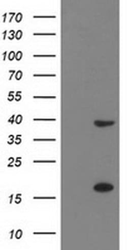 PDLIM2 Monoclonal Antibody (OTI12A5), TrueMAB , OriGene 100 &mu;L; Unconjugated:Antibodies,