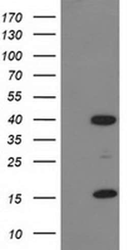 PDLIM2 Monoclonal Antibody (OTI9A11), TrueMAB , OriGene 30 &mu;L; Unconjugated:Antibodies,