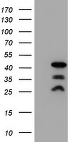 PDLIM2 Monoclonal Antibody (OTI14D9), TrueMAB , OriGene 30 &mu;L | Buy Online | Origene Technologies | Fisher Scientific